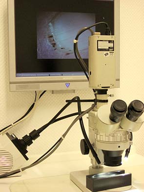 Kapillarmikroskopie